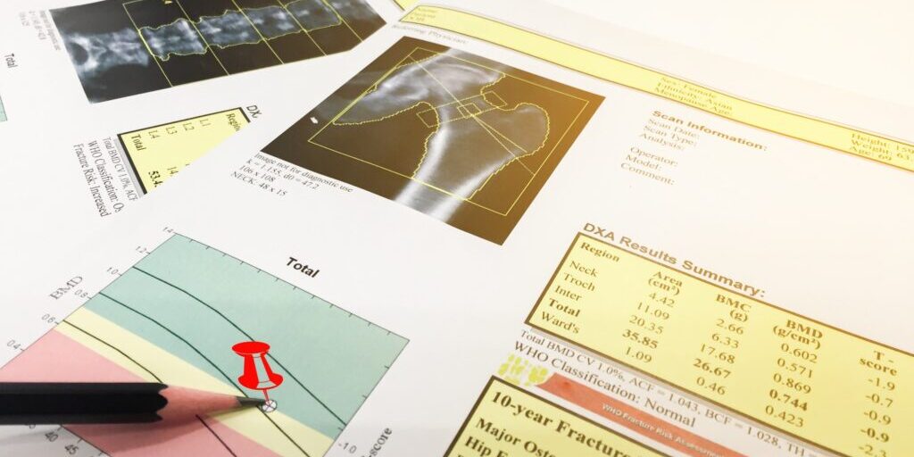 DXA Scanning